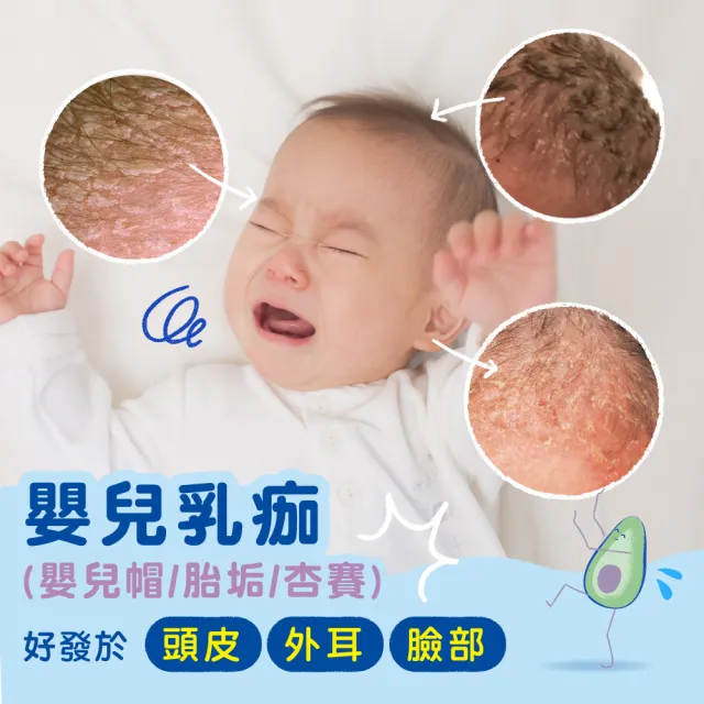 【Mustela 慕之恬廊】慕之幼 頭皮照護組(寶寶頭皮調理霜40ml＋潔髮慕絲150ml 胎垢雙寶 清潔胎垢乳痂杏賽)