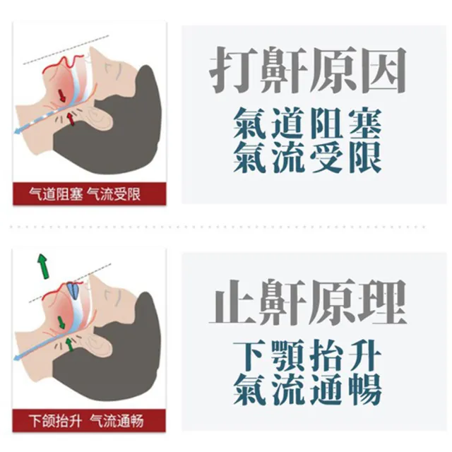 【靜舒眠】防打呼止鼾帶1入(止鼾 防打鼾 止鼾帶 止鼾器 小臉)