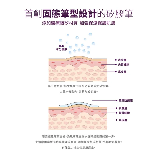 【安適康AnsCare】蕾寧皙卡疤痕護理矽膠筆(4g/盒)