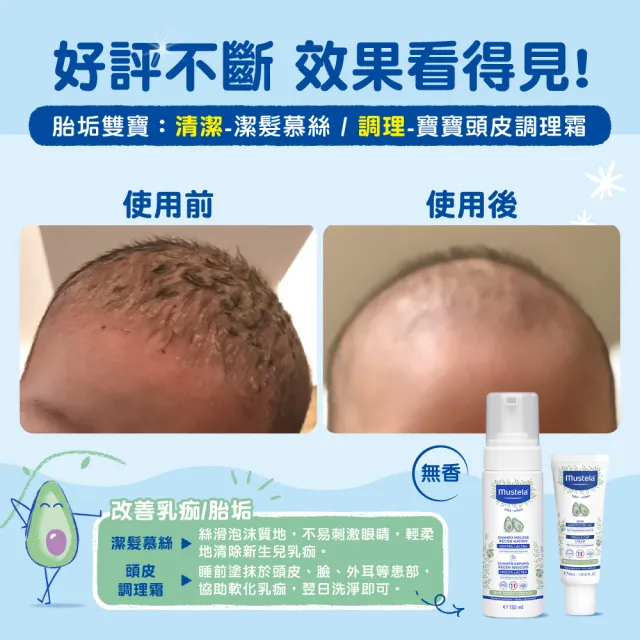 【Mustela 慕之恬廊】慕之幼 寶寶頭皮調理霜 40ml(清潔胎垢/調理皮脂分泌)