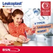【Leukoplast必史恩BSN】德國2.5cm抗水透氣醫用膠帶 有蓋設計(德國百年品牌 高品質法國製造)