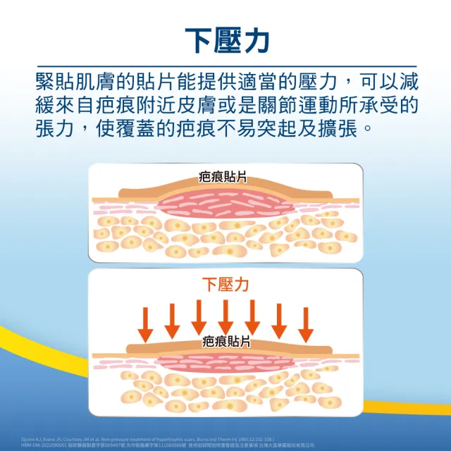 【HiruDerm 喜能膚】疤痕貼片5cmX5cm 1盒(5片/盒)