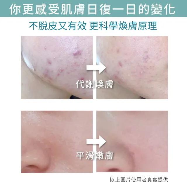 【UNICAT 變臉貓】水楊酸毛孔調理原液｜粉刺代謝｜細緻毛孔｜平衡油脂｜ 30ml(改善粉刺 細緻毛孔 平衡油脂)