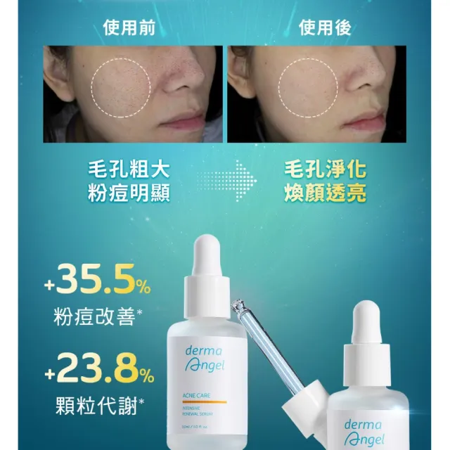 【derma Angel 護妍天使】保濕煥膚1+1雙效精華組(益菌生保濕修復極效精華30ml+三重酸極效煥膚精華30ml)