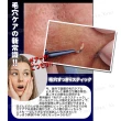 【kiret】黑頭粉刺神器不鏽鋼彎口粉刺夾-彎頭彎嘴夾深層清理鼻頭局部 夾粉刺針 粉刺棒(彎勾 鑷子 角栓夾)