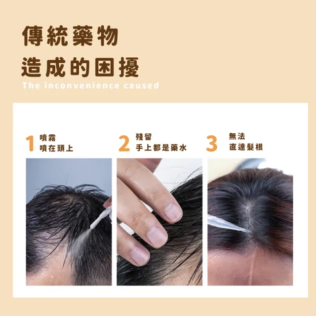 【禿頭救星】電動頭皮上藥器(紅光 頭部☆珠 按摩儀 按摩器 震動器 導液梳 給藥器 頭皮護理 毛囊)