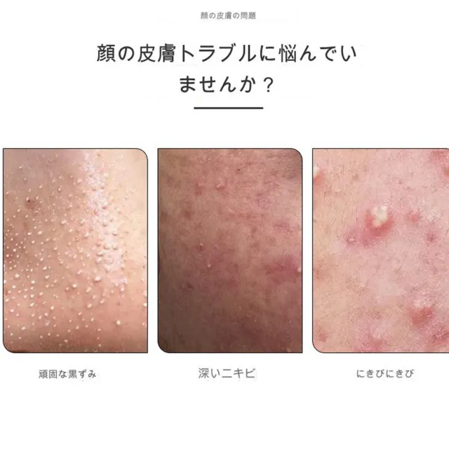 【DIVA】日式原田職人專業極輕量鈦合金高度細緻細胞夾(彎鉤粉刺夾 痘夾 美容師愛用款)