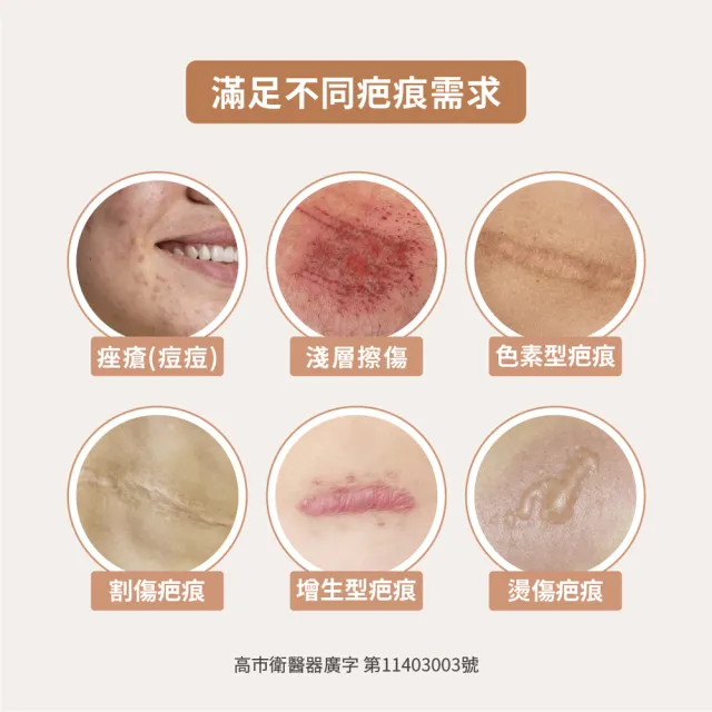 【TAICEND 泰陞】疤痕凝膠 10g(市售唯一使用於子母線)