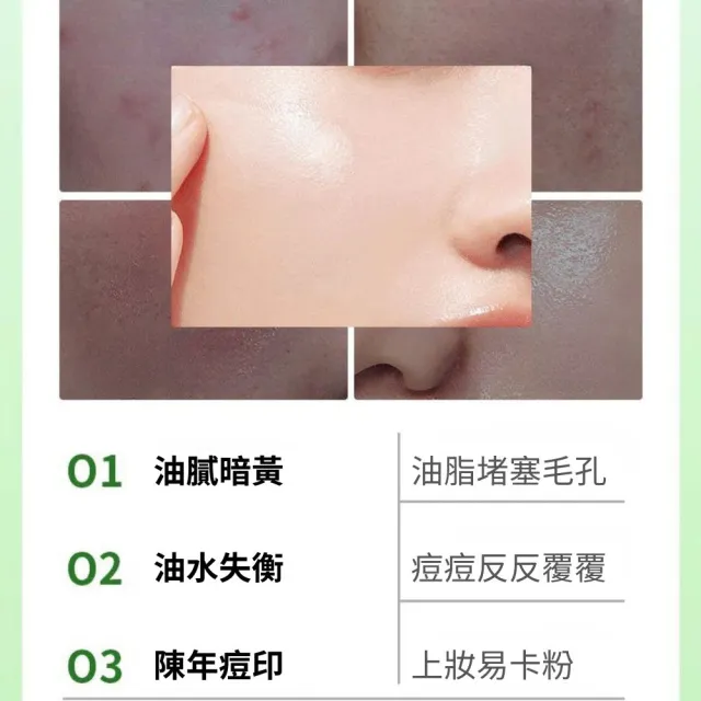 【iBloom】洛婭水楊酸果酸次拋精華液 1.5ml/支*30支-2入組(痘痘 痘印 痘坑 水楊酸 清爽控油)