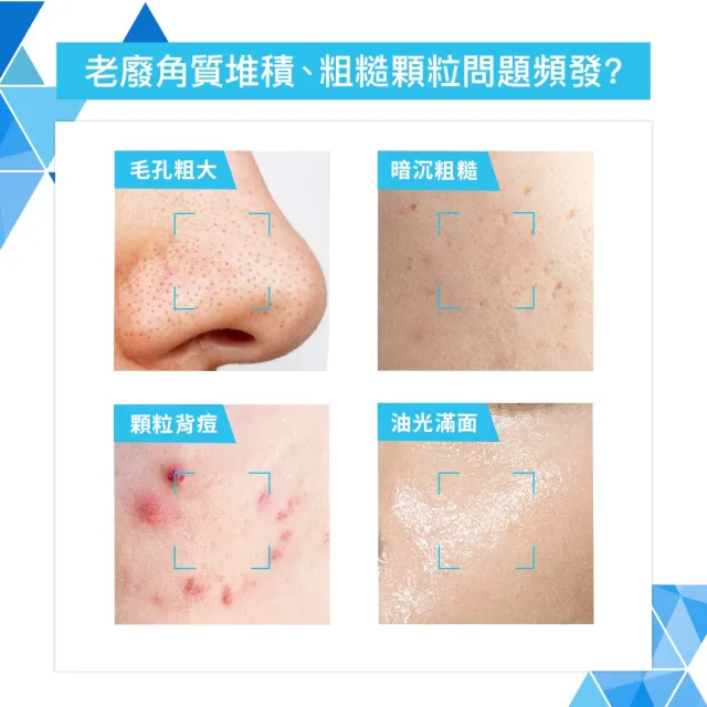 【CeraVe 適樂膚】家庭囤貨組★水楊酸煥膚淨嫩潔膚露 473ml*3 年度限定組_A(改善乾燥粗糙顆粒)