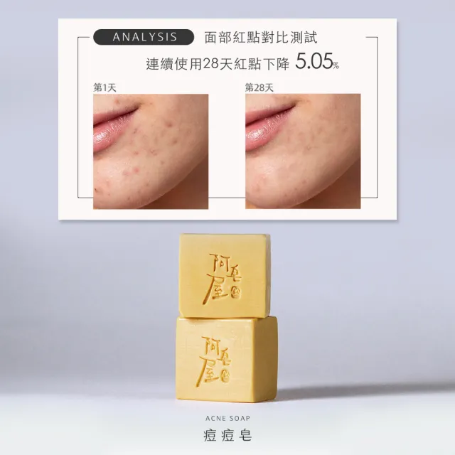 【阿皂屋】手工皂-痘痘皂推薦(痘痘肌-控油-漢方植萃-香皂-肥皂)