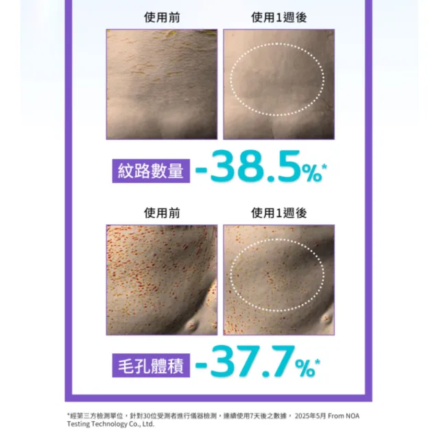 【derma Angel 護妍天使】1%緊緻撫紋A醇微晶精華(30ml)