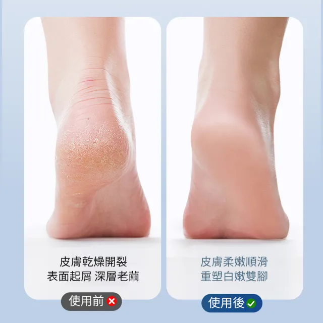 【Ouboo】無線電動去死皮磨腳器 足部護理刮腳皮器 腳後跟美足磨腳皮機(三檔調節/雙磨頭/防水)