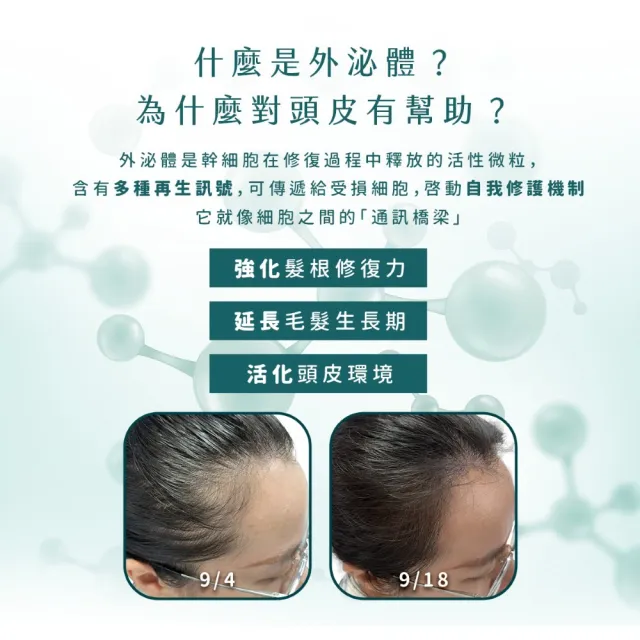 【SH-RD 史高師設】人類外泌體活化養髮精華50ml(外泌體、頭皮養髮、滋養活絡頭皮、強健髮根、頭皮洗髮精)