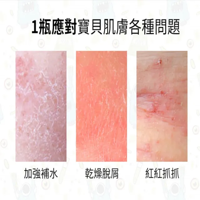 【Hallmark】怪獸派對 自然之萃寶寶全面修護乳 120ml(舒緩 滋潤 身體保養 肌膚友善)