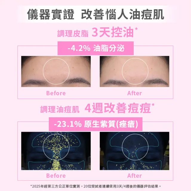 【SHIMBI METHOD 審美之選】5%杜鵑花酸控油煥膚精華