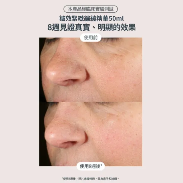 【StriVectin 皺效奇蹟】歐美緊實冠軍★美頸拉提組(繃繃頸霜50ml+繃繃精華50ml)