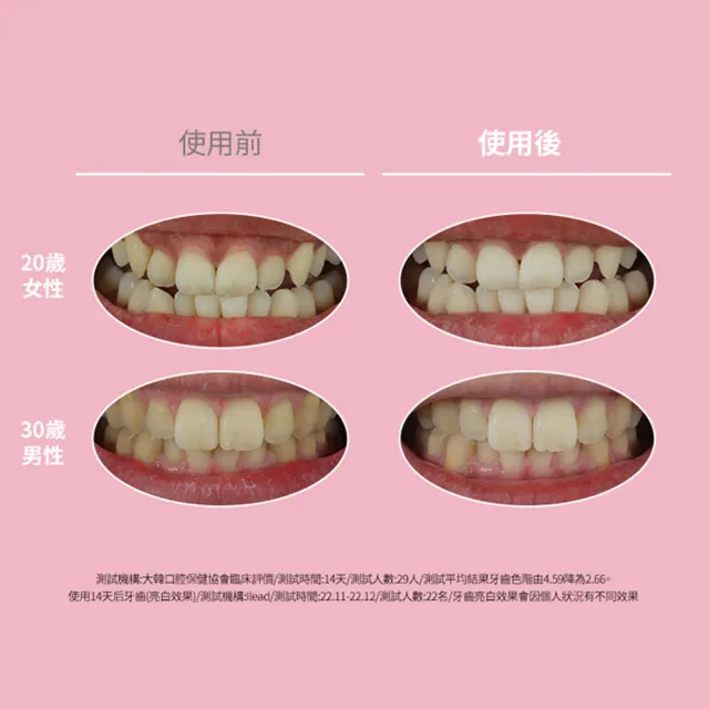 【Euthymol】粉紅亮白牙膏2入(送牙刷5入)