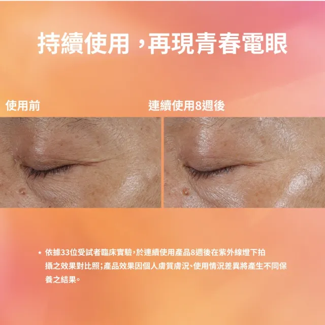【StriVectin 皺效奇蹟】維他命C煥白勻亮眼霜15ml(黑眼圈/保濕修護/7日淡化暗沉)
