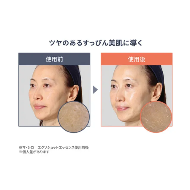 【生日限定組】日本製Mashiro高濃度7293億外秘生胎盤精華液(1入)
