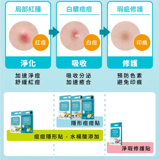 【derma Angel 護妍天使】獨家組 - 隱形痘痘貼 小痘綜合組180貼(一般日用 120貼+高效水膠體 60貼)