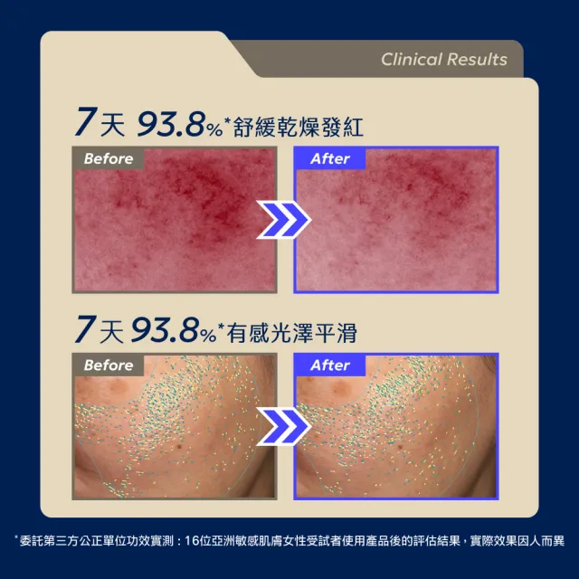 【AQUAMAX 奧科美氏】Exorigin泌蘭PDRN舒敏新生超級精華30ml-新生小蘭瓶PRO、女大推薦、植泌體、敏弱肌