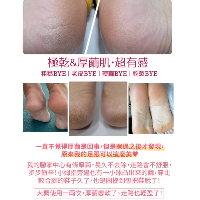 【古寶無患子】藥妝系列-果然有酵煥膚修護手足霜3入組(軟化角質/去角質/嫩膚/滋潤)