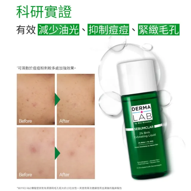 【DermaLab 德美醫研】2%水楊酸煥膚調理水160ml