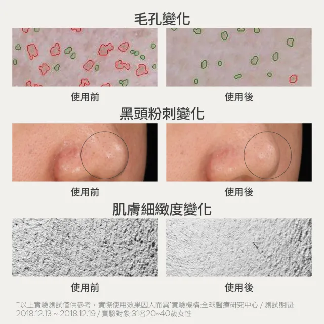 【innisfree】超級火山泥毛孔潔淨面膜 80g (2入組/毛孔吸塵器/水楊酸/控油)