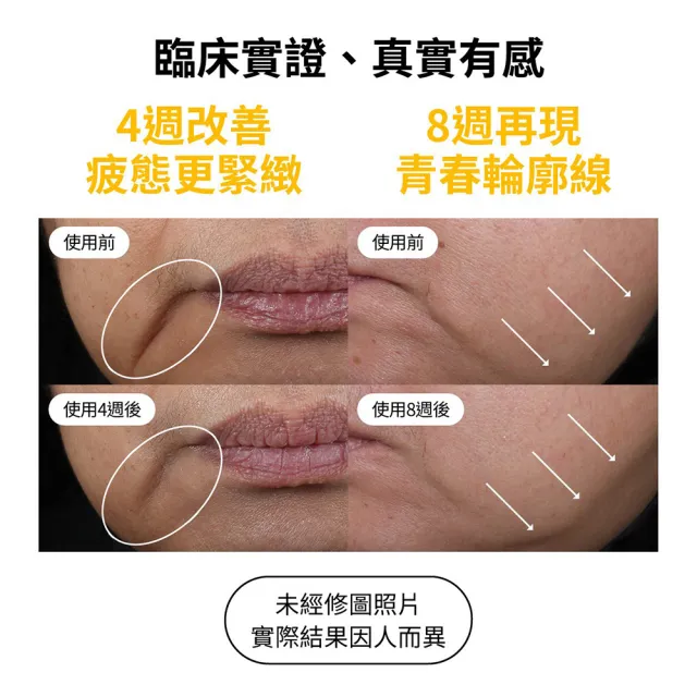 【StriVectin 皺效奇蹟】皺效緊緻繃繃臉霜50ml(冠軍臉霜/V臉拉提/術後保養)