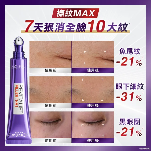 【L’OREAL Paris 巴黎萊雅】全新升級! 玻尿酸眼霜級撫紋精華霜-按摩頭版30ml_3入組(冰熨斗MAX3.0)