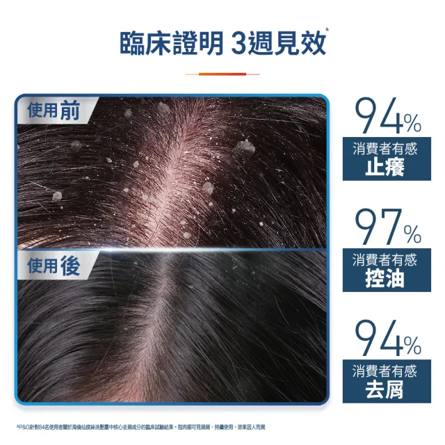 【海倫仙度絲】科研去屑洗髮精300g x3入(去油淨透/瞬效止癢)