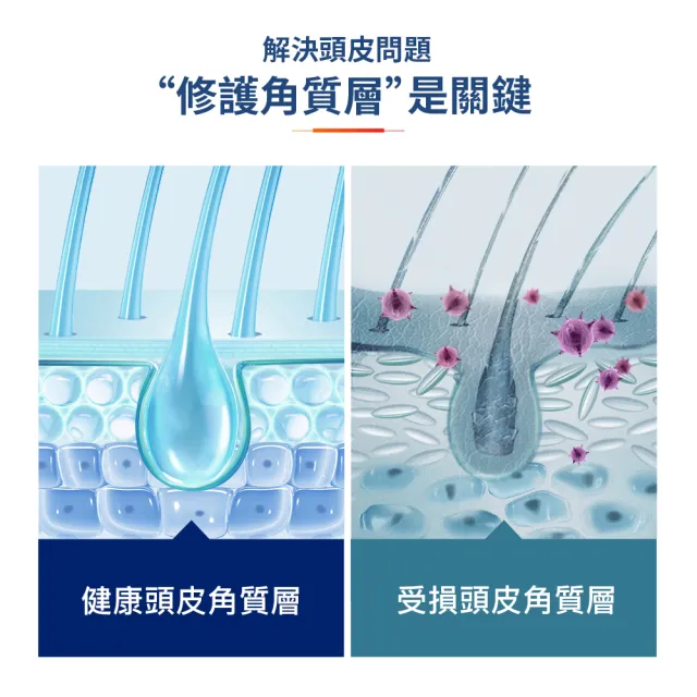【海倫仙度絲】科研去屑洗髮精300g x3入(去油淨透/瞬效止癢)