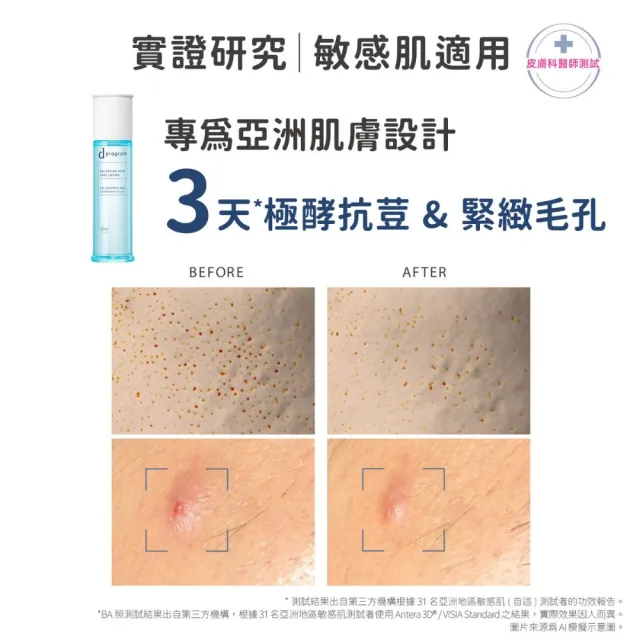 【d program 敏感話題】極效淨膚均衡化粧乳+化粧水(補充包) (淨膚/保濕 任選)(敏感肌/敏弱肌)