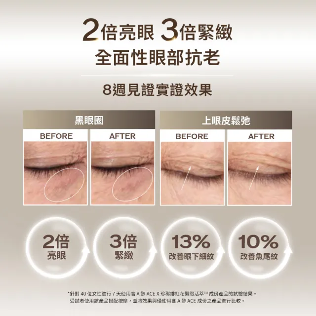 【SHISEIDO 資生堂國際櫃】激抗痕亮采緊緻ACE眼霜15mL(眼霜/抗老/撫紋/拉提)