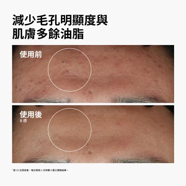 【The Ordinary】10%菸鹼醯胺 + 1%鋅精華 60ml