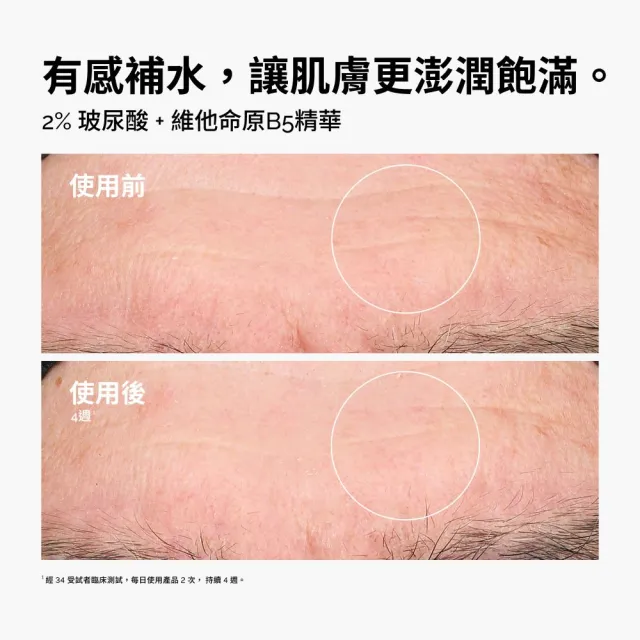 【The Ordinary】明星肌膚修護組 | 10% 菸鹼醯胺+1% 鋅精華＆2%玻尿酸+維他命原B5 精華